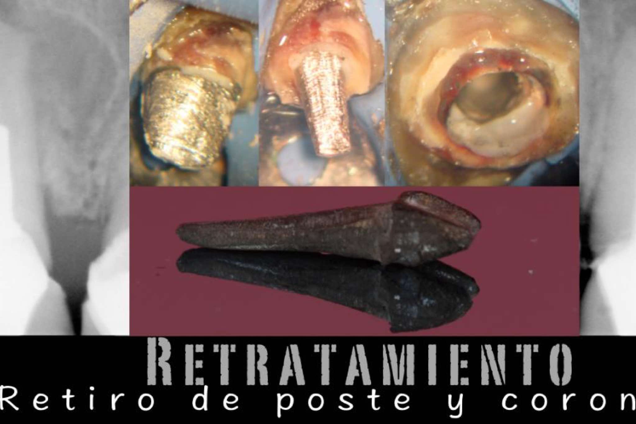 exibid_retirodeposteyco2.jpeg